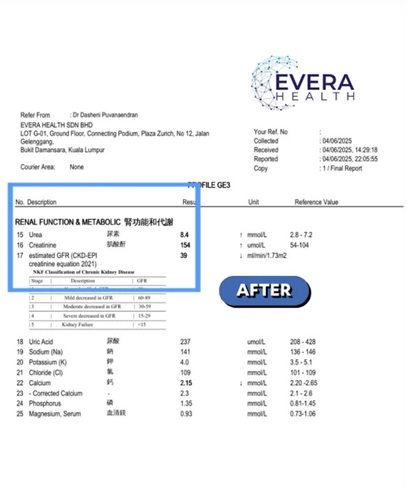CKD Case 2 After
