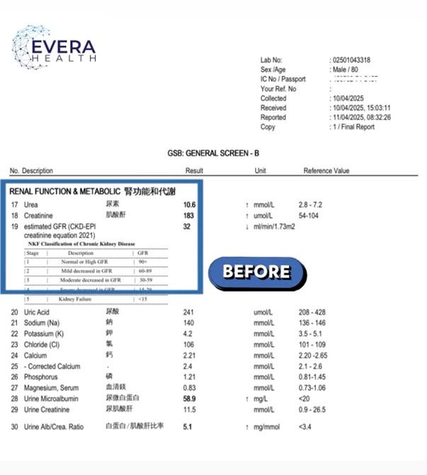 CKD Case 2 Before