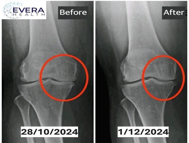 Joint Mobility & Cartilage Support